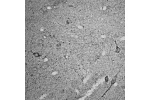 Immunohistochemistry (IHC) image for anti-Ras Homolog Gene Family, Member A (RHOA) (AA 100-150) antibody (ABIN351037)