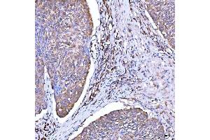 IHC analysis of Syntaxin 18/STX18 using anti-Syntaxin 18/STX18 antibody (ABIN7599259).