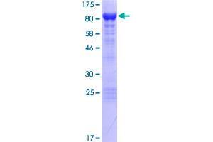 Image no. 1 for Neurochondrin (NCDN) (AA 1-729) protein (GST tag) (ABIN1312090) (NCDN Protein (AA 1-729) (GST tag))
