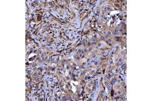 IHC analysis of Septin 11/SEPTIN11 using anti-Septin 11/SEPTIN11 antibody (ABIN7602925). (Septin 11 抗体  (C-Term))