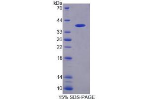 SDS-PAGE analysis of Human PTPN9 Protein. (PTPN9 蛋白)