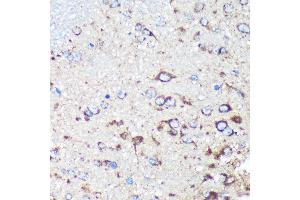 Immunohistochemistry of paraffin-embedded Rat brain using STNL Rabbit pAb (ABIN7270585) at dilution of 1:100 (40x lens). (STARD3NL 抗体  (AA 185-234))