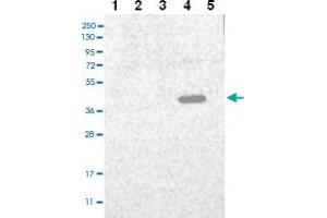 Western blot analysis of Lane 1: RT-4 Lane 2: U-251 MG Lane 3: Human Plasma Lane 4: Liver Lane 5: Tonsil with C3orf33 polyclonal antibody ( Cat # PAB27996 ) at 1:100 - 1:250 dilution. (C3orf33 抗体)