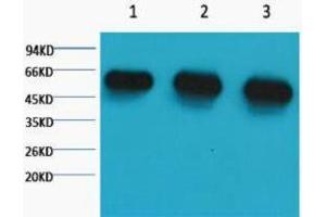 Western Blotting (WB) image for anti-alpha Tubulin (TUBA1) antibody (ABIN3181107) (alpha Tubulin 抗体)