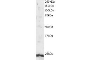 ABIN184801 staining (2µg/ml) of Human Testis lysate (RIPA buffer, 30µg total protein per lane). (ARL4A 抗体  (N-Term))