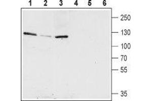Western blot analysis of rat hippocampus (lanes 1 and 4), mouse brain (lanes 2 and 5) and rat brain (lanes 3 and 6) lysates: - 1-3. (KCNQ5 抗体  (C-Term, Intracellular))