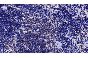 Detection of IFNa/bR1 in Rat Spleen Tissue using Polyclonal Antibody to Interferon Alpha/Beta Receptor 1 (IFNa/bR1)