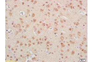 Formalin-fixed and paraffin embedded rat brain labeled with Rabbit Anti IGFBP6 Polyclonal Antibody, Unconjugated (ABIN753298) at 1:200 followed by conjugation to the secondary antibody and DAB staining