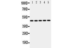 Western Blotting (WB) image for anti-Interferon Regulatory Factor 3 (IRF3) (AA 409-427), (C-Term) antibody (ABIN3043039) (IRF3 抗体  (C-Term))