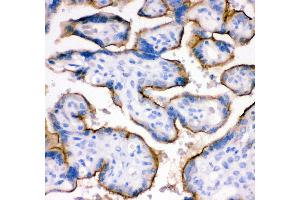 Anti- TFRC antibody,IHC(P) IHC(P): Human Placenta Tissue (Transferrin Receptor 抗体  (AA 1-198))