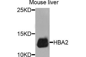 Western blot analysis of extracts of mouse liver cells, using HBA2 antibody.