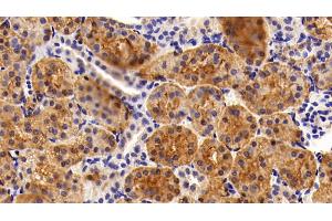 Immunohistochemistry (IHC) image for anti-Galectin 3 (LGALS3) (AA 1-250) antibody (ABIN7431560)