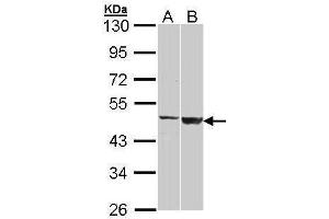 WB Image Sample (30 ug of whole cell lysate) A: H1299 B: Raji 10% SDS PAGE antibody diluted at 1:1000 (GAL3ST1 抗体)