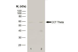 Western blot analysis of HeLa whole cell lysate (1) and HeLa heat stressed whole cell lysate (2) probed with RAT ANTI CCT THETA (ABIN119785) followed by F(ab')2 RABBIT ANTI RAT IgG:HRP (ABIN121399). (CCT8 抗体)