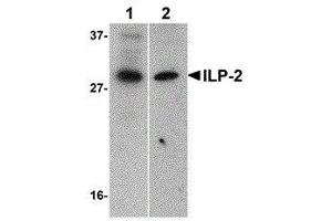 Western Blotting (WB) image for anti-Baculoviral IAP Repeat-Containing 8 (BIRC8) (AA 2-13) antibody (ABIN2475064) (ILP-2 抗体  (AA 2-13))