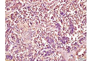 Immunohistochemistry (IHC) image for anti-Smad1/5 Protein (SMAD1/5) (AA 361-465) antibody (ABIN732158)