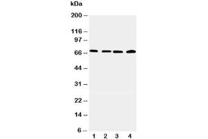 Western Blotting (WB) image for anti-Interleukin-1 Receptor-Associated Kinase 2 (IRAK2) (C-Term) antibody (ABIN3031491)