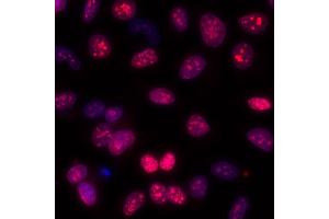 Immunofluorescence (IF) image for anti-Antigen Identified By Monoclonal Antibody Ki-67 (MKI67) (AA 1200-1250) antibody (ABIN7448915)