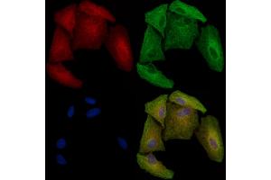 Phospho-HRH1 (Ser398) Antibody staining A549 cells(heat shock treatment) by IF/ICC.