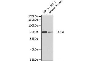Western blot analysis of extracts of various cell lines using RORA Polyclonal Antibody at dilution of 1:1000.