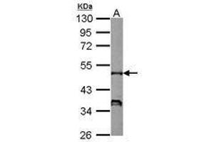 Image no. 1 for anti-Neutrophil Cytosol Factor 1 (NCF1) (AA 1-228) antibody (ABIN1501901) (NCF1 抗体  (AA 1-228))