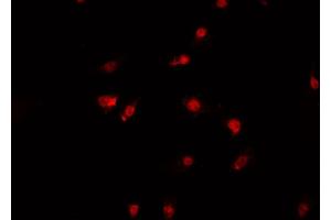 ABIN6269390 staining A-431 cells by IF/ICC. (Aurora Kinase B 抗体)