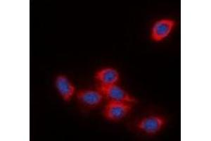 Immunofluorescent analysis of DOK2 staining in HeLa cells. (DOK2 抗体)