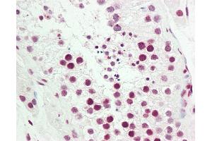 Immunohistochemistry (IHC) image for anti-Nuclear Receptor Subfamily 2, Group F, Member 2 (NR2F2) (AA 1-30) antibody (ABIN1977972)