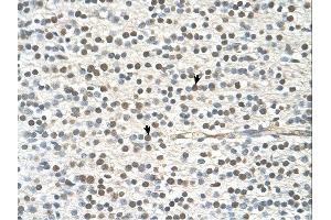 GAPVD1 antibody was used for immunohistochemistry at a concentration of 4-8 ug/ml.