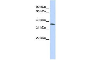 Western Blotting (WB) image for anti-Family with Sequence Similarity 164, Member A (FAM164A) antibody (ABIN2457929) (FAM164A 抗体)