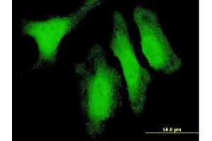 Immunofluorescence of monoclonal antibody to DUSP14 on HeLa cell. (DUSP14 抗体  (AA 1-198))