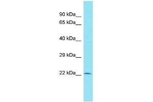Host: Rabbit Target Name: C11orf40 Sample Type: Hela Whole cell lysates Antibody Dilution: 1. (C11orf40 抗体  (N-Term))