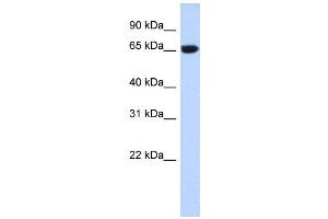 WB Suggested Anti-GTPBP2 Antibody Titration:  0.