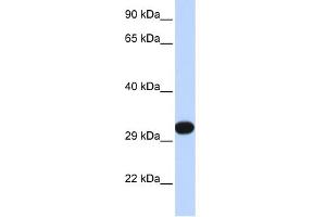 WB Suggested Anti-PDGFB Antibody Titration: 0. (PDGFB 抗体  (N-Term))