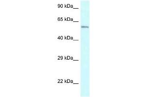 Western Blot showing CYP2U1 antibody used at a concentration of 1 ug/ml against Jurkat Cell Lysate (CYP2U1 抗体  (Middle Region))