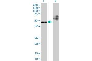 Western Blot analysis of STARD3 expression in transfected 293T cell line by STARD3 monoclonal antibody (M01), clone 1D1. (STARD3 抗体  (AA 1-445))