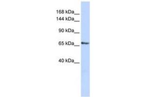 Image no. 1 for anti-RNA Binding Motif Protein 26 (RBM26) (AA 701-750) antibody (ABIN6743034) (RBM26 抗体  (AA 701-750))