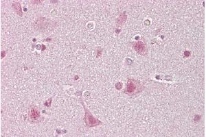 Immunohistochemistry (IHC) image for anti-Sterol Regulatory Element Binding Transcription Factor 1 (SREBF1) (Middle Region) antibody (ABIN2792233) (SREBF1 抗体  (Middle Region))