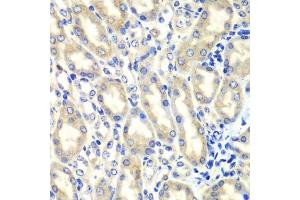 Immunohistochemistry (Paraffin-embedded Sections) (IHC (p)) image for anti-Prostaglandin E Synthase 2 (PTGES2) (AA 88-377) antibody (ABIN6146404)