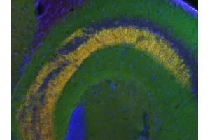 Indirect immunostaining of a PFA fixed mouse hippocampus section with anti-synapsin 3 (dilution1 : 500; red) and guinea pig anti-synapsin 1,2 (cat. (Synapsin III 抗体  (AA 417-434))