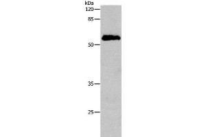 Western Blot analysis of Human cervical cancer tissue using CDC20 Polyclonal Antibody at dilution of 1:600 (CDC20 抗体)
