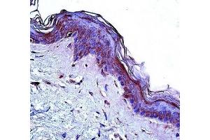Immunohistochemistry (IHC) image for anti-CD1a (CD1a) (AA 75-104) antibody (ABIN3030364)