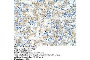 Rabbit Anti-EXOSC6 Antibody  Paraffin Embedded Tissue: Human Liver Cellular Data: Hepatocytes Antibody Concentration: 4. (EXOSC6 抗体  (N-Term))
