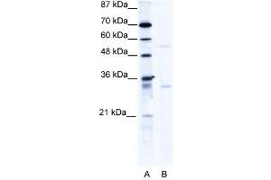 Western Blot showing TRIM17 antibody used at a concentration of 1-2 ug/ml to detect its target protein. (TRIM17 / RNF16 抗体  (C-Term))