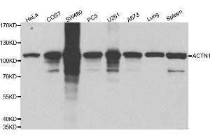 Western blot analysis of extracts of various cell lines using ACTN1 antibody. (ACTN1 抗体  (AA 1-330))