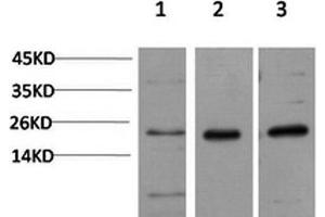 Western Blot analysis of 1) Hela, 2)3T3, 3) PC-12 cells using CBX5 Monoclonal Antibody at dilution of 1:1000. (CBX5 抗体)