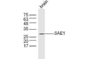 Mouse brain lysates probed with SAE1 Polyclonal Antibody, Unconjugated  at 1:300 dilution and 4˚C overnight incubation. (SAE1 抗体  (AA 1-100))