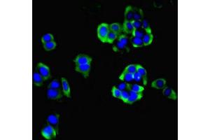 Immunofluorescent analysis of PC-3 cells using ABIN7155229 at dilution of 1:100 and Alexa Fluor 488-congugated AffiniPure Goat Anti-Rabbit IgG(H+L) (HIATL1 抗体  (AA 450-506))