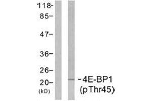 Western Blotting (WB) image for anti-Eukaryotic Translation Initiation Factor 4E Binding Protein 1 (EIF4EBP1) (AA 13-62), (pThr46) antibody (ABIN1531764)