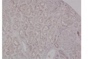 Immunohistochemistry (IHC) image for anti-Mismatch Repair Protein 2 (MSH2) (N-Term) antibody (ABIN2776761)